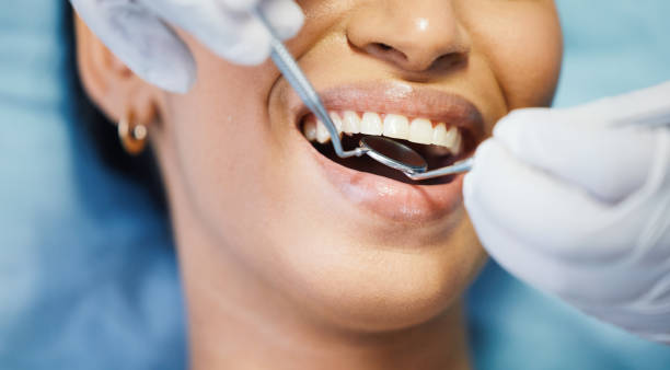 Best Emergency Treatment for Dental Infections or Abscesses in Montevlo, AL