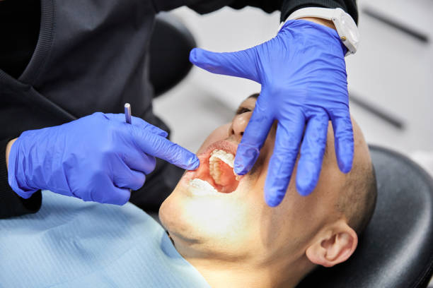 Best Emergency Wisdom Teeth Removal in Montevlo, AL