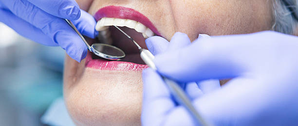 Best Emergency Gum Treatment in Montevlo, AL
